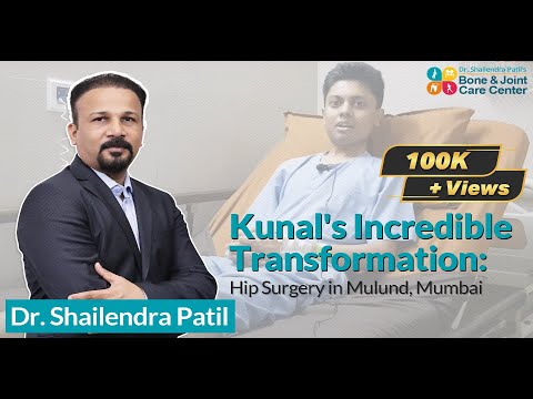 Mr. Kunal Giving Review After Hip Replacement Surgery In Mulund || Hip Surgery By Best Hip Surgeon