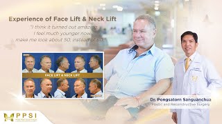 Christopher Alan Walhs Face Lift & Neck Lift by Dr. Pongsatorn Sanguanchua