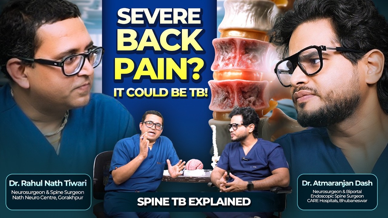 Spinal Tuberculosis Explained