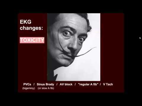 Digoxin EKG changes:  "EM in 5"