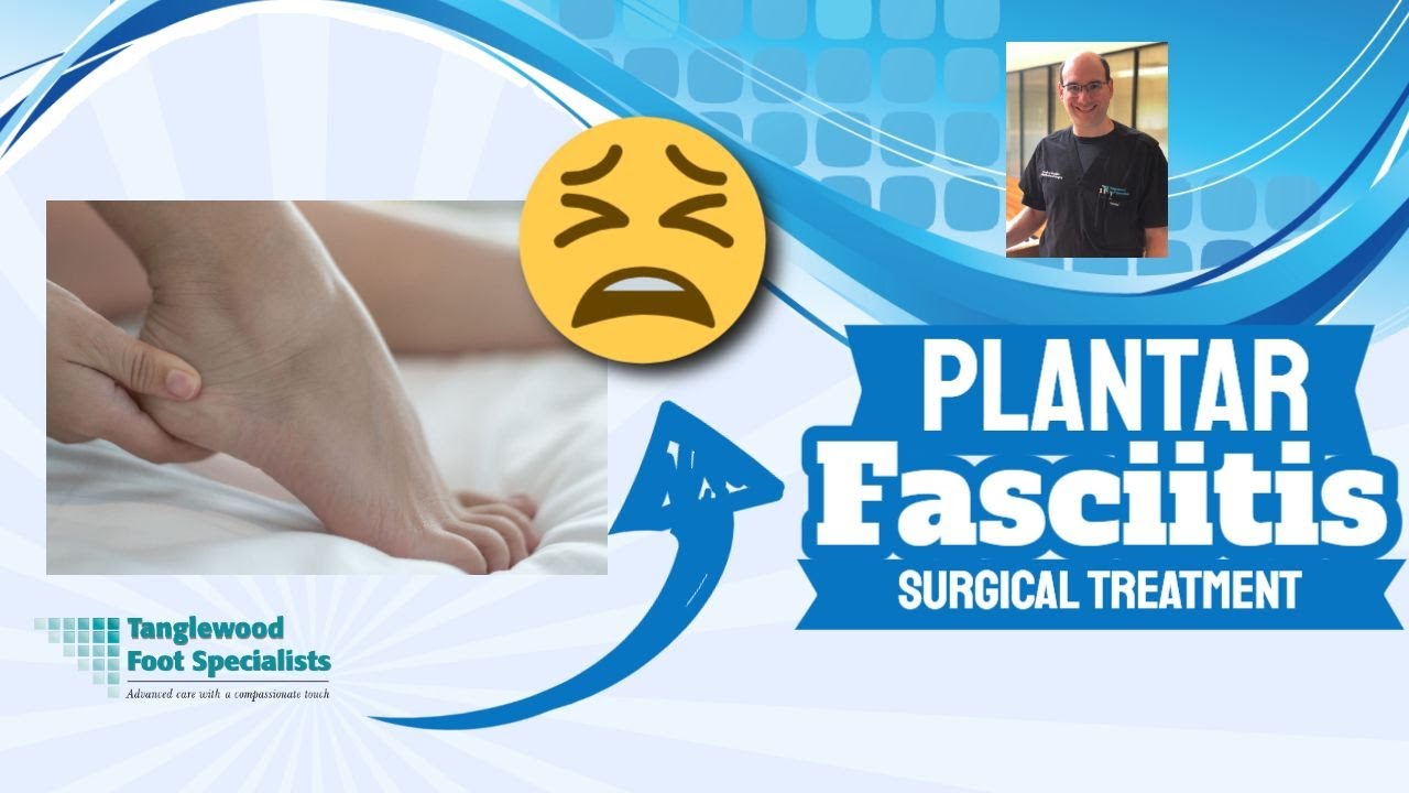 Solving Plantar Fasciitis with Advanced Surgical Treatment