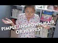 Pimple Ingrown Hair Or Herpes
