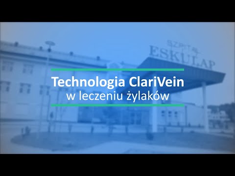 CLARIVEIN nowa metoda zamykania żylaków kończyn