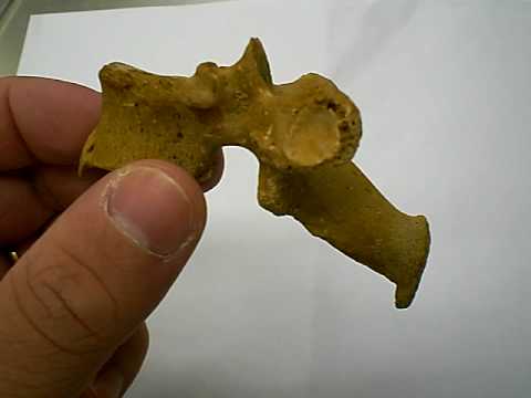 Migliori prodotti con il calcio per le articolazioni Piccioni grumi sul trattamento articolazioni