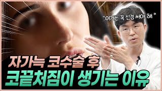 자가늑 코수술 후 코끝처짐이 생기는 이유 | 자가늑 쓴다고 다 코처짐이 안 생기는 것이 아닙니다!