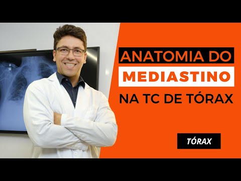 TOMOGRAFIA DE TÓRAX: ANATOMIA NA JANELA DE MEDIASTINO