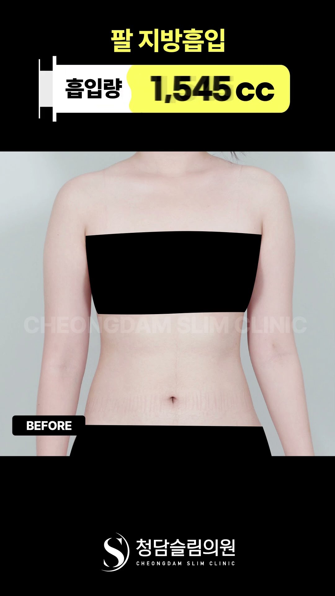 팔이 가벼워 보이는 이유, 기록해봄 📝