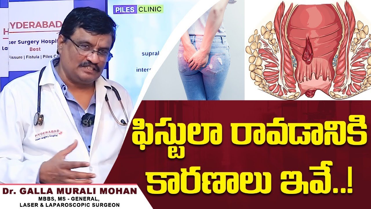 Fistula Laser Treatment Video 7