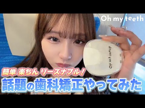 【歯列矯正】歯並びコンプレックスとさよならしました。