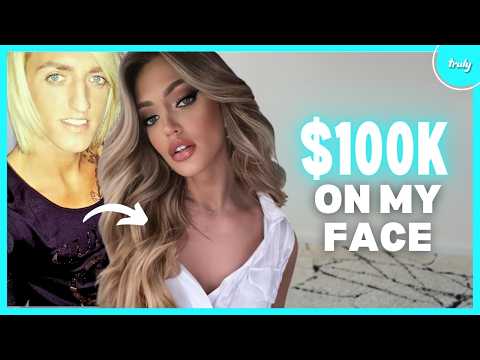 I'm Trans And Spent Over $100k 'Feminising' My Face | HOOKED ON THE LOOK