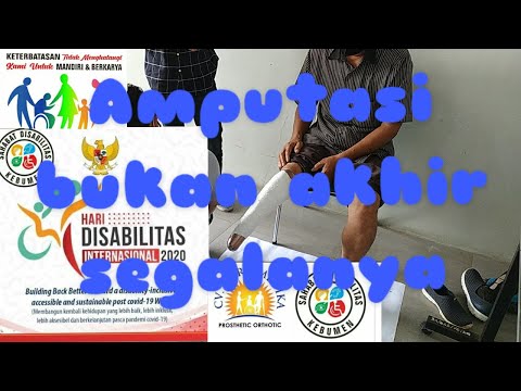 PENGUKURAN KAKI PALSU AMPUTASI KAKI DIBAWAH LUTUT | SDK | JAPRO MEDIKA | 2.12.2020