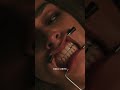 Best Revenge Taken By Dr Freddy
