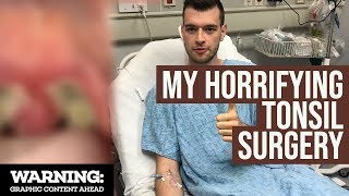 Tonsillectomy Surgery GONE WRONG! | My Terrifying Experience and Recovery