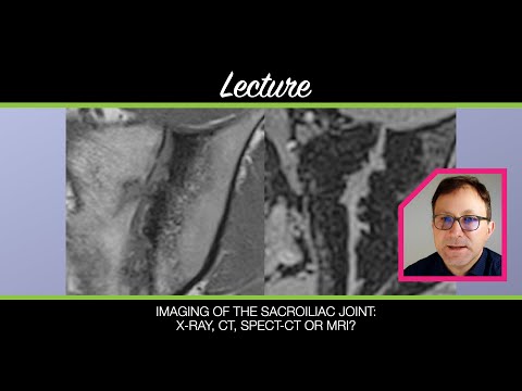 Imaging of the sacroiliac joint - Lecture by Prof. Kay G. Hermann - X-ray, CT, SPECT-CT and MRI