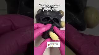Black skull 💀 pimple popping #asmr #viral