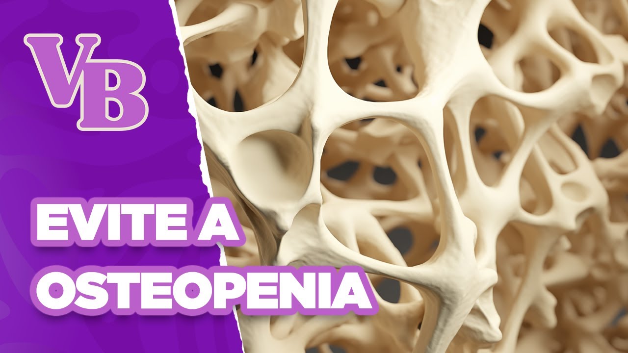 Saiba como evitar a OSTEOPENIA - Você Bonita (04/11/2024)