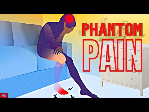 PHANTOM PAIN AND TREATMENT