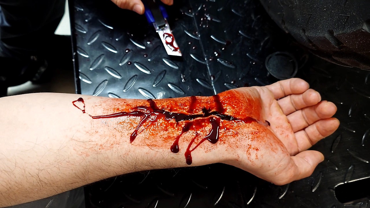 Starke Blutungen und Erste Hilfe