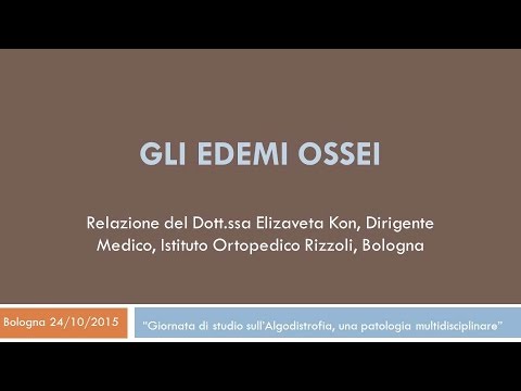Mal di malati basso addome e la vita non mensile Artrosi del ginocchio come rimuovere un tumore