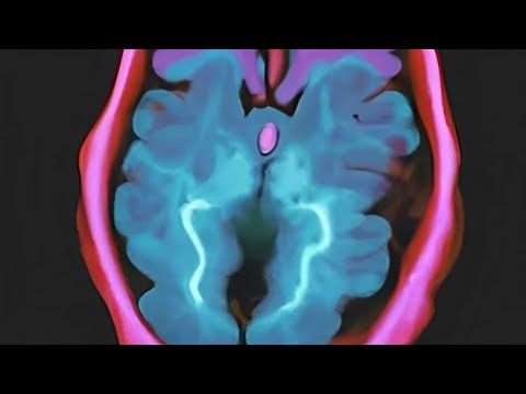 Neurobiological Risk Factors for Violence Part 1 (Forensic Psychology, Spring 2024)