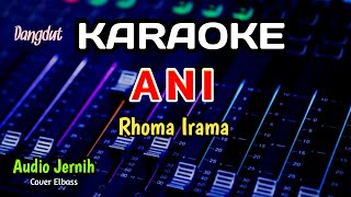 Download lagu ANI - RHOMA IRAMA - KARAOKE - COVER ELBASS mp3