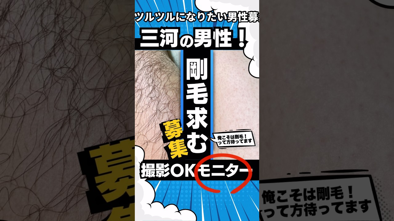 【三河】男性の剛毛求む！「シュガーリング脱毛」動画撮影モニター(モデル)募集※材料費のみ