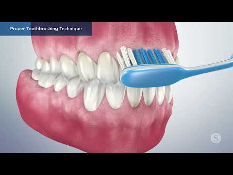Proper Toothbrushing Techniques