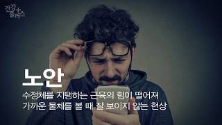 <b>노화</b>의 시작, 주름이 아닌 노안! [건강플러스] 미리보기 썸네일