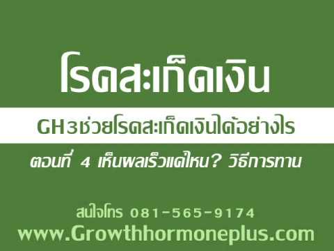 ยาพื้นบ้านสำหรับกลาก การรักษาอายุรเวทของโรคสะเก็ดเงิน
