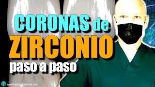 TRATAMIENTO PASO a PASO con CORONAS DE ZIRCONIO para NO tener problemas en el futuro del tratamiento