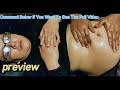 Navel Oil Massage Preview Navel Oil Massage Bellymassage Trending Viralvideo Trendingvideo