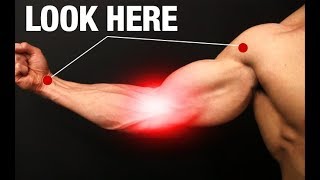 How to Fix Elbow Pain (ONE SIMPLE EXERCISE!)