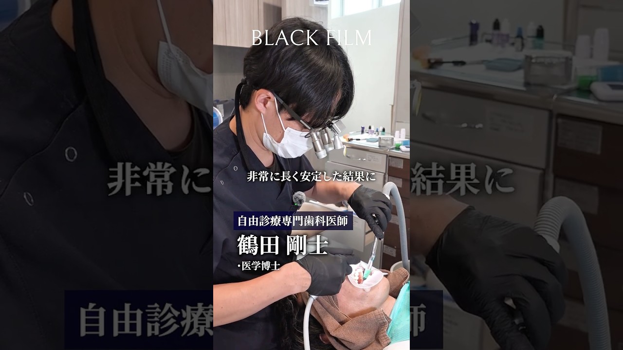 自然な透明感で自分だけのスマイルを手に入れる、削らないラミネートベニア『ブラックフィルム』#歯医者 #セラミック #審美歯科