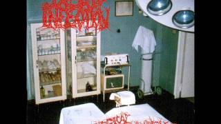 dead infection - surgical disembowelment - side one
