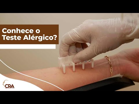 Teste Alergico ou Prick Test