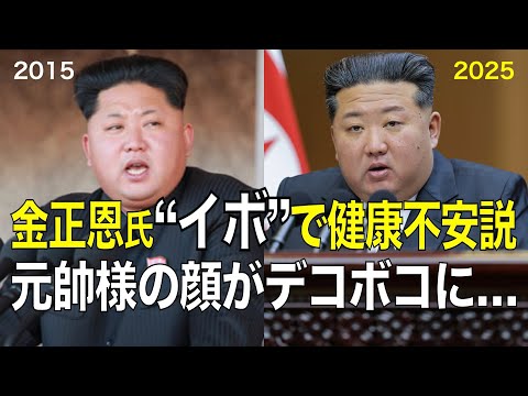 「金正恩の顔がデコボコに」北朝鮮内部から不安の声（デイリーNKジャパン）｜ｄメニューニュース（NTTドコモ）