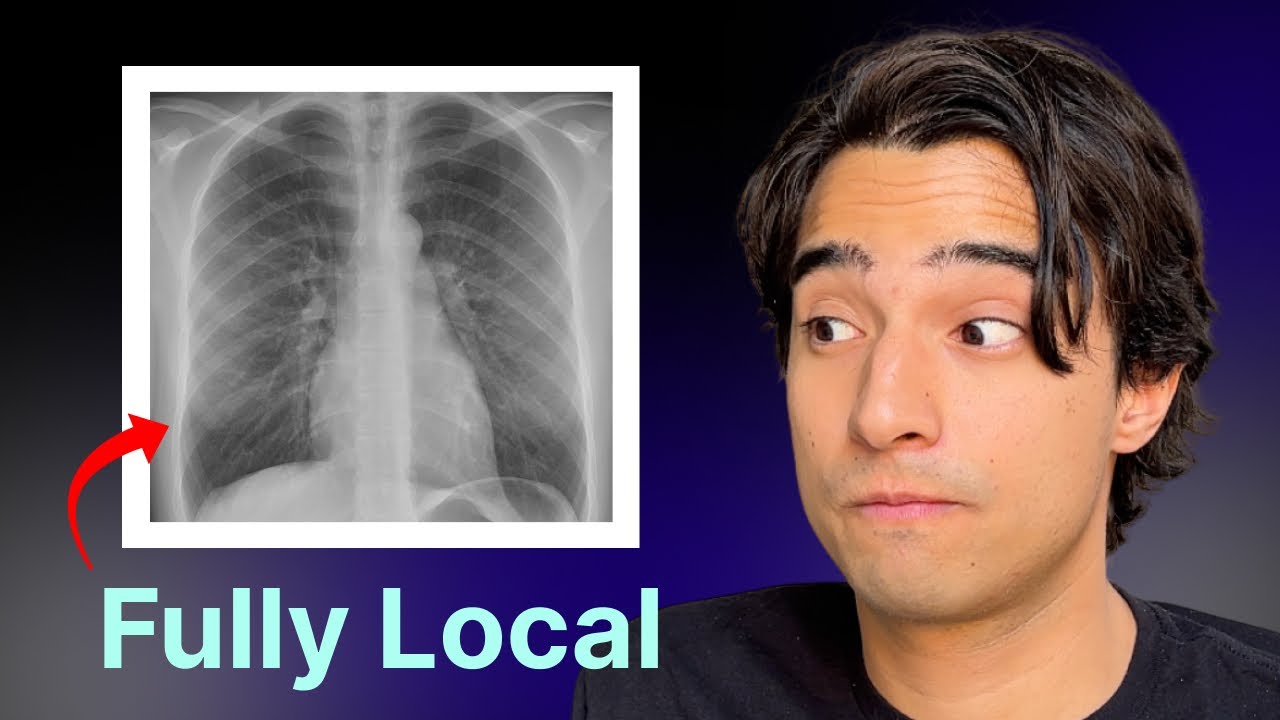 MedGemma 1.5: Google's Open-Source Medical AI with 3D Imaging (Tutorial)