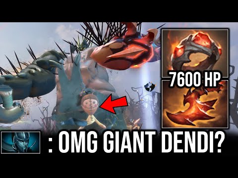 it's like you're playing against GIANT DENDI...