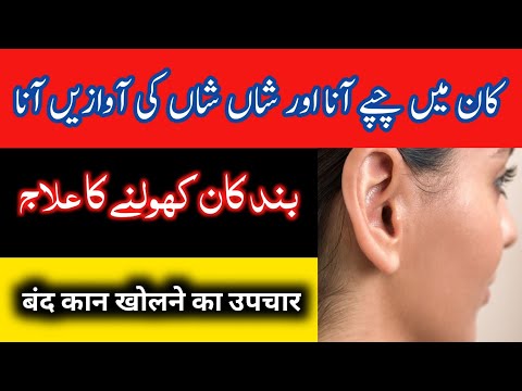 Kan me chappe aana | Kaan mein sayen sayen hona | Kaan me awaz aane ka ilaj | Tinnitus treatment