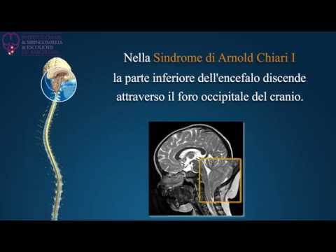 Ricetta di dolori articolari con rafano Displasia del ginocchio che è
