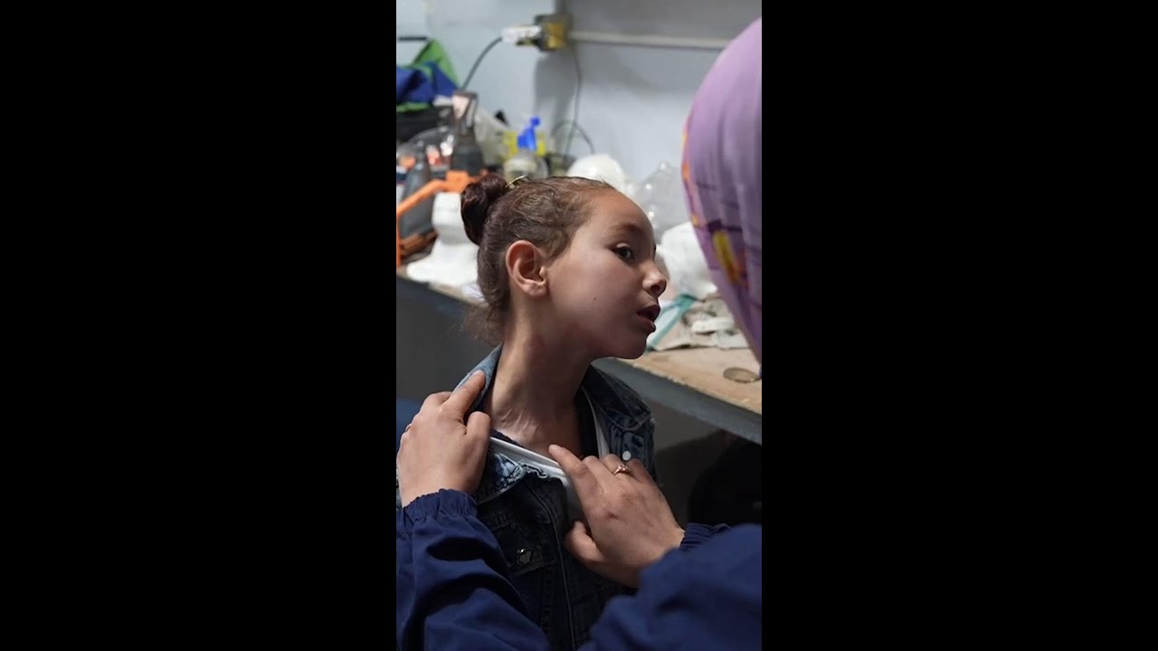 #Gaza: Doctors Without Borders uses 3D masks to treat patients with facial burns