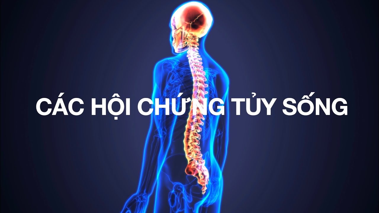Các hội chứng tuỷ sống