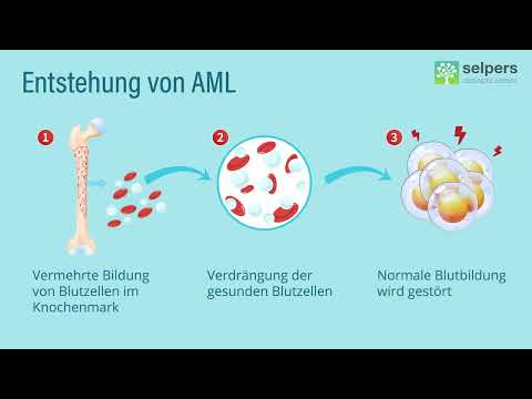 AML explained simply ❕ What is Acute Myeloid Leukemia? (Expert explains)