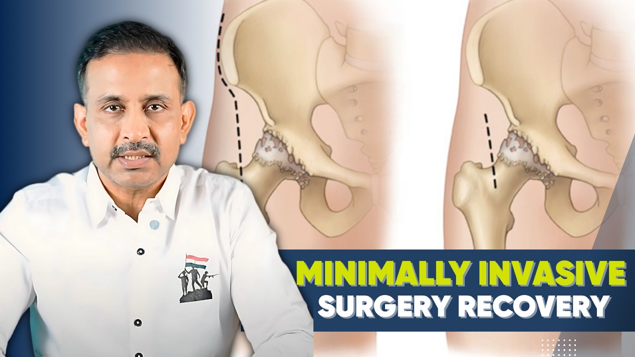 MIS THR or Conventional- what's the difference ? (Minimally Invasive Total Hip Replacement)