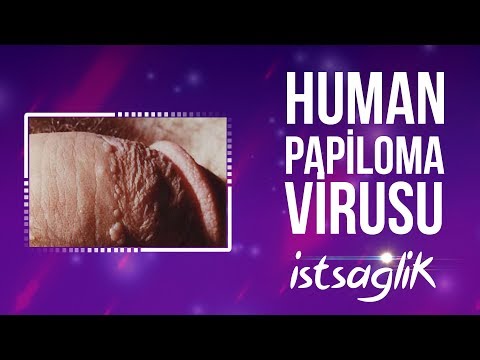 ce alimente nu le plac paraziții umani condiloame în colon