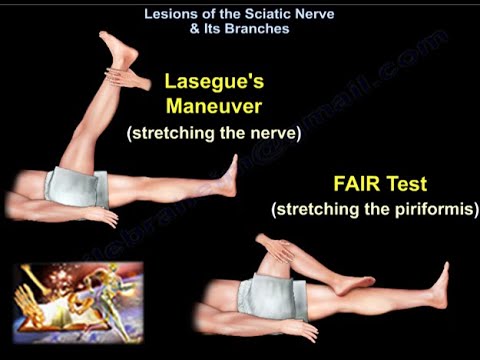 Lesions Of The Sciatic Nerve & Its Branches - Everything You Need To Know - Dr. Nabil Ebraheim