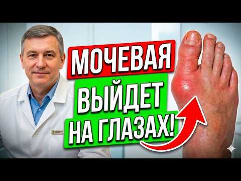 Кто бы мог подумать, что подагра боится обычной... Один продукт — и приступы уходят