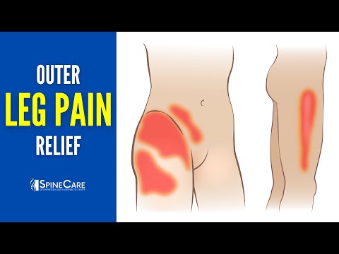 How to INSTANTLY Relieve Outer Leg Pain