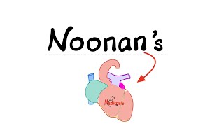 Download lagu Noonan Syndrome - The Mushroom mnemonic mp3