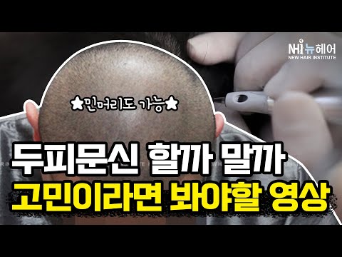 (ENG/JPN)두피문신 고민이라면 무조건 봐야할 영상 - 뉴헤어 I [두피문신][모발이식]